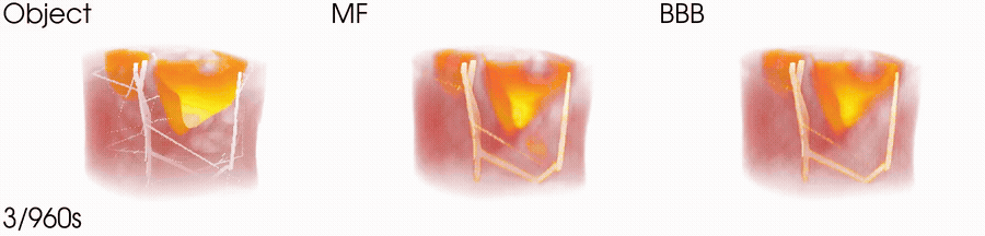 PACTMF_SPIE2025.gif