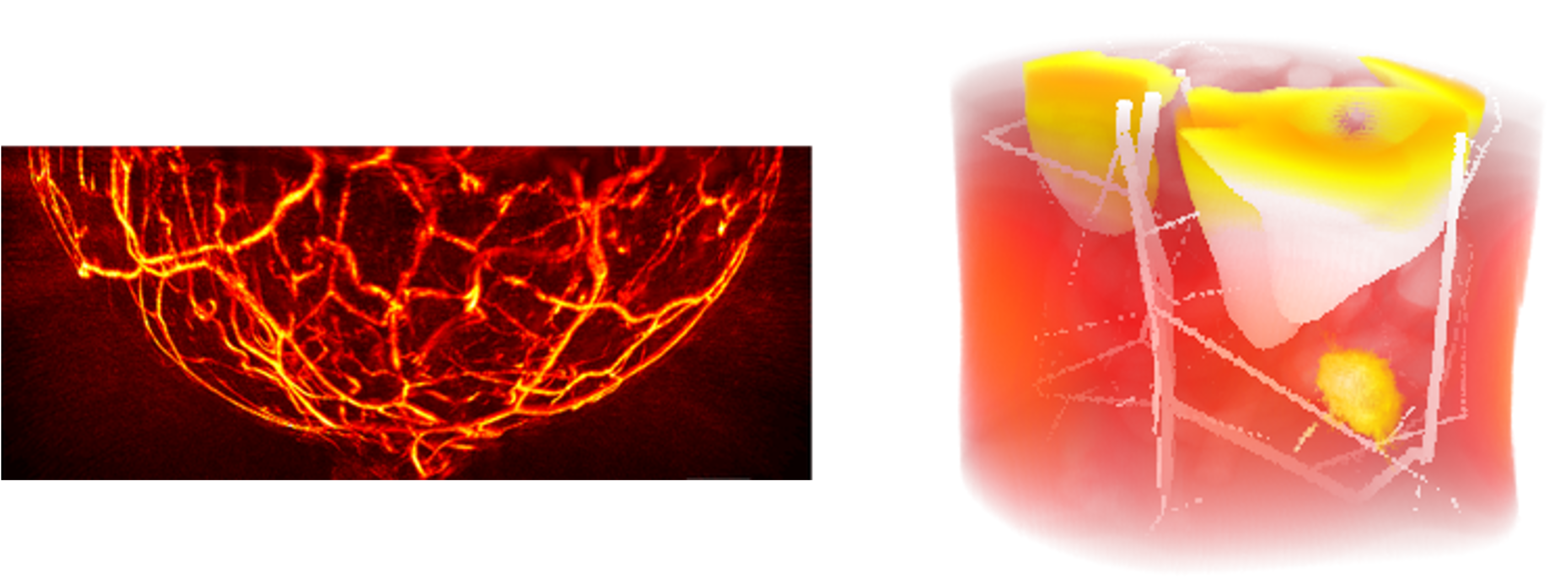 Photoacoustic computed tomography — vascular and volumetric imaging